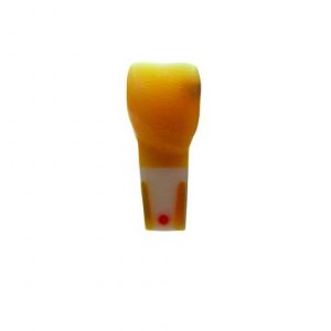 Meiteeth 11, fully anatomical with caries defect